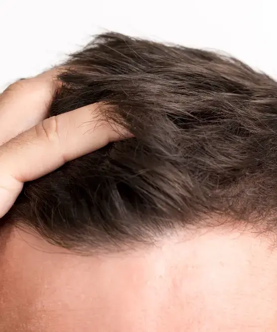 Close-up of a hand parting dark hair to expose the scalp and the hair roots